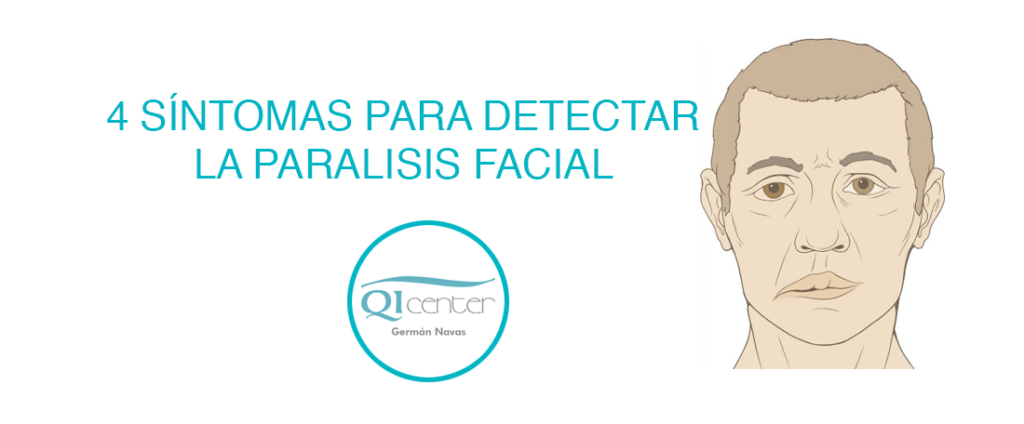 Cabecera parálisis facial acupuntura Málaga