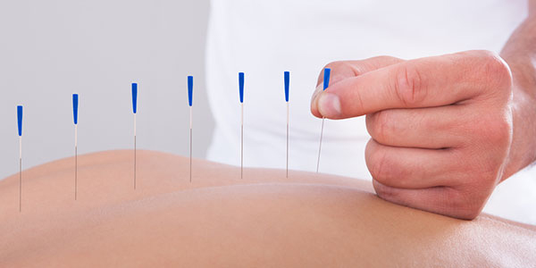 acupuntura fertilidad malaga