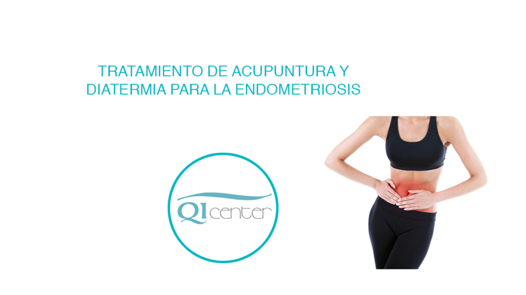 Cabecera tratamiento acupuntura para la endometriosis en Malaga