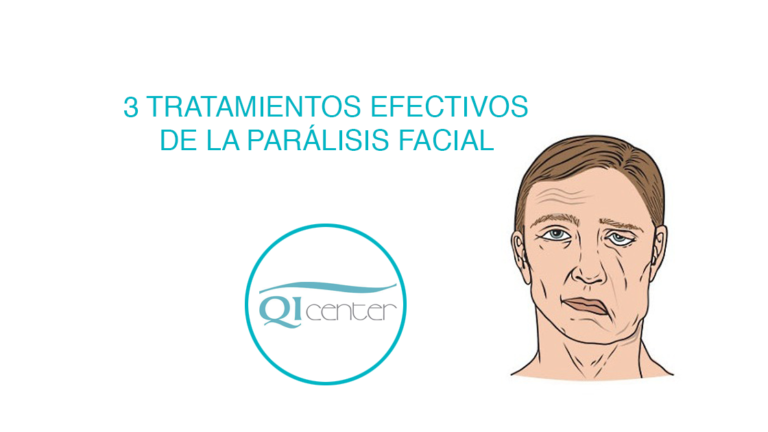 Tratamiento paralisis facial fisioterapia en malaga